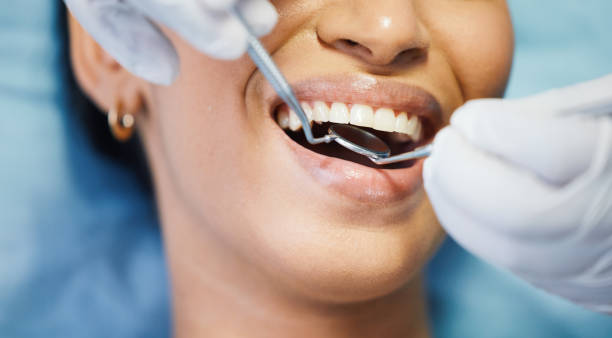 Best Emergency Dental Care for Broken or Chipped Teeth in Federal Heights, CO